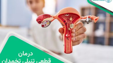 درمان تنبلی تخمدان