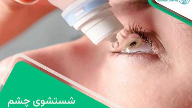 شستشوی چشم
