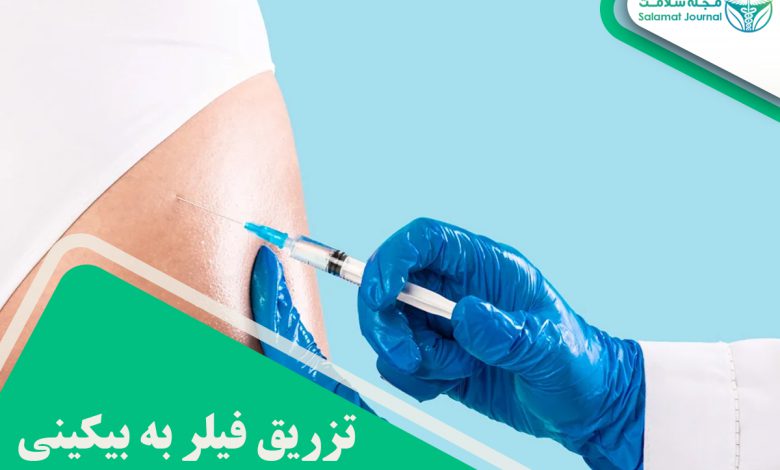 تزریق فیلر به بیکینی
