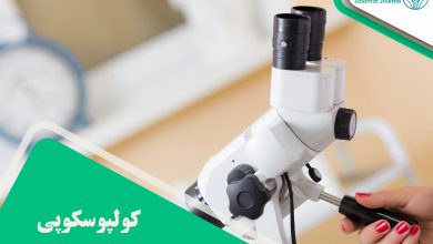 کولپوسکوپی