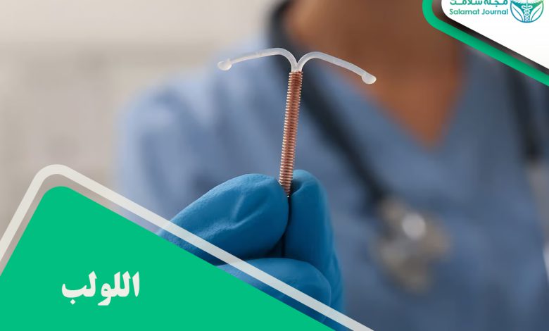 اللولب