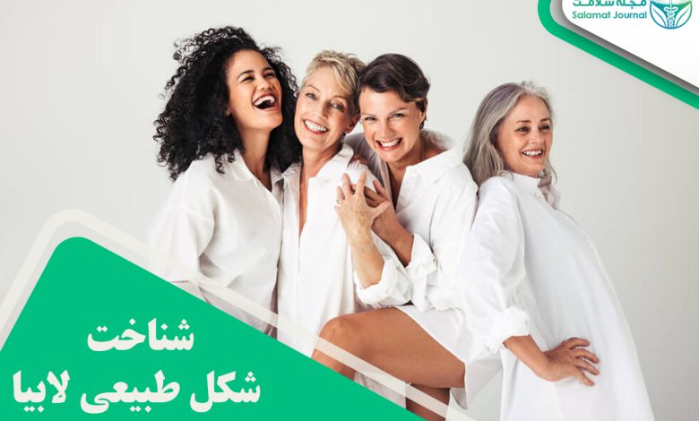 شکل طبیعی لابیا