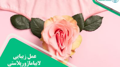 عمل زیبایی لابیاماژورپلاستی