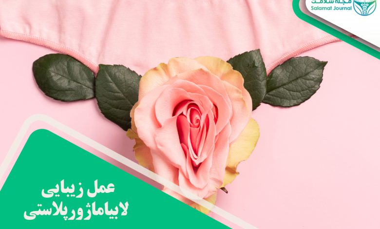 عمل زیبایی لابیاماژورپلاستی