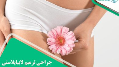 جراحی ترمیم لابیاپلاستی