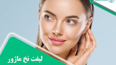 لیفت نخ ماژور
