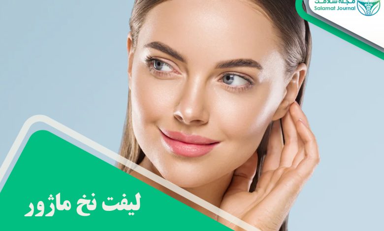 لیفت نخ ماژور