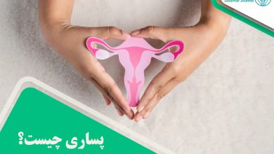 دستگاه پساری