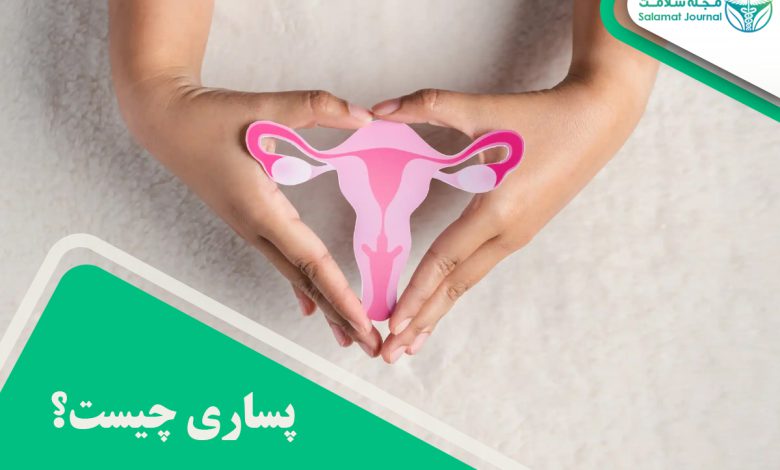 دستگاه پساری