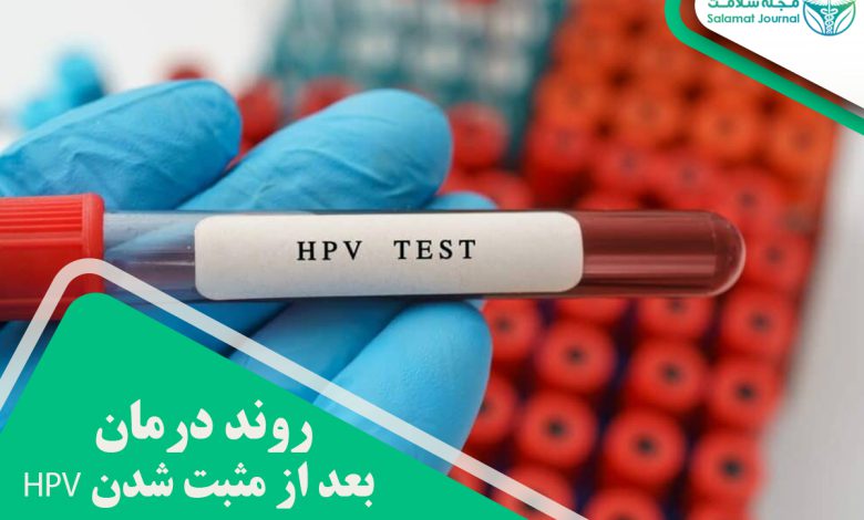 روند درمان بعد از مثبت شدن HPV