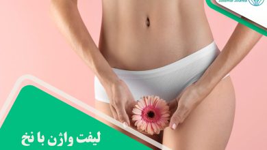 لیفت واژن با نخ