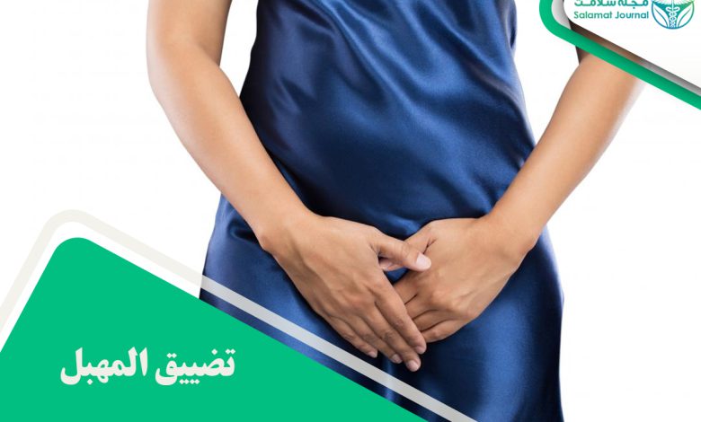تضييق المهبل