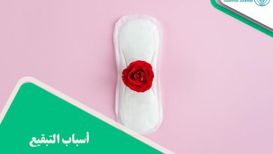 أسباب التبقيع