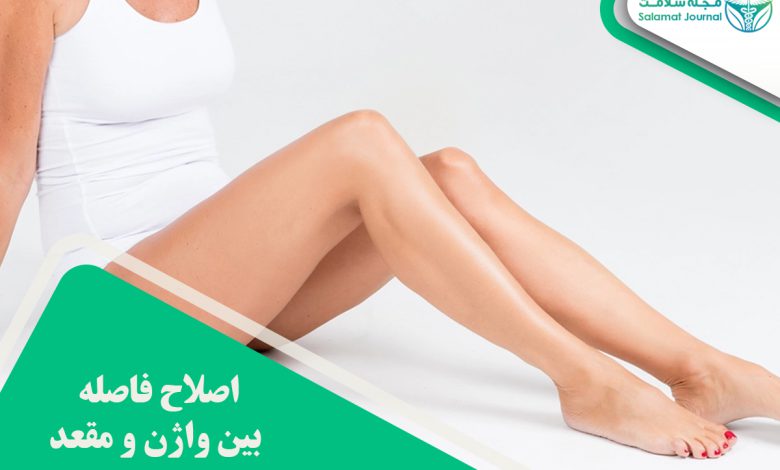 اصلاح فاصله بین واژن و مقعد