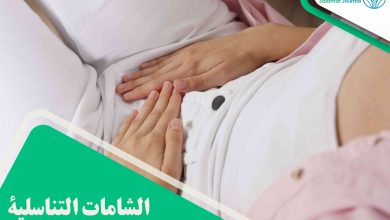 الشامات التناسلية