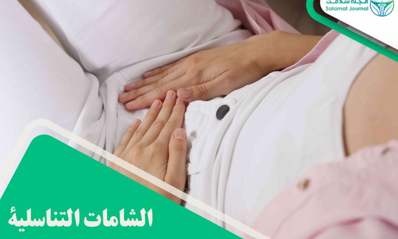 الشامات التناسلية