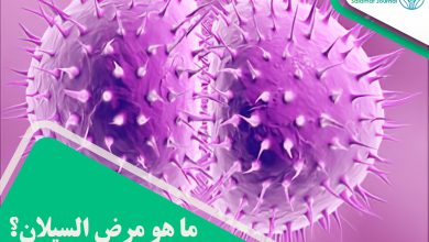 مرض السیلان