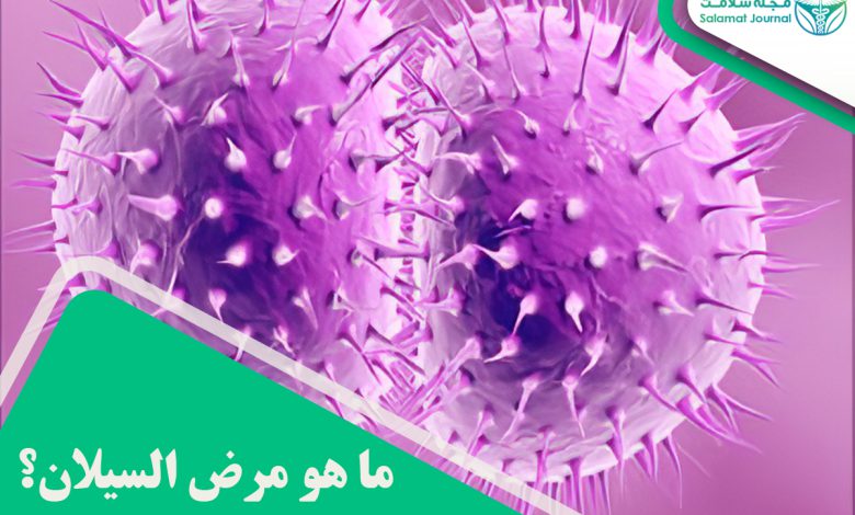 مرض السیلان